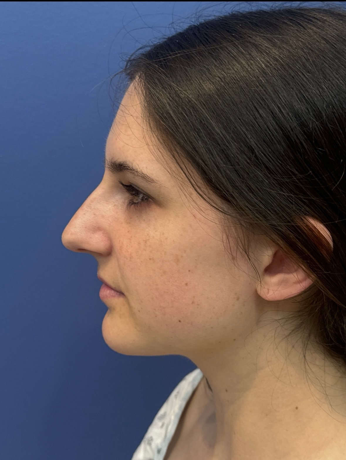 ImportedPhoto.765829754.244841