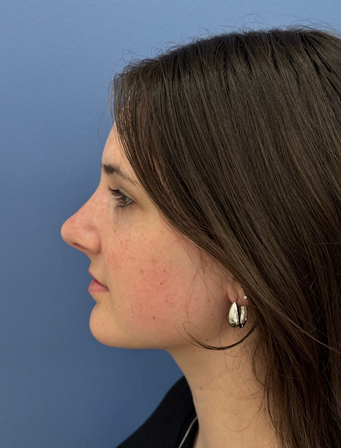 ImportedPhoto.765829754.245381